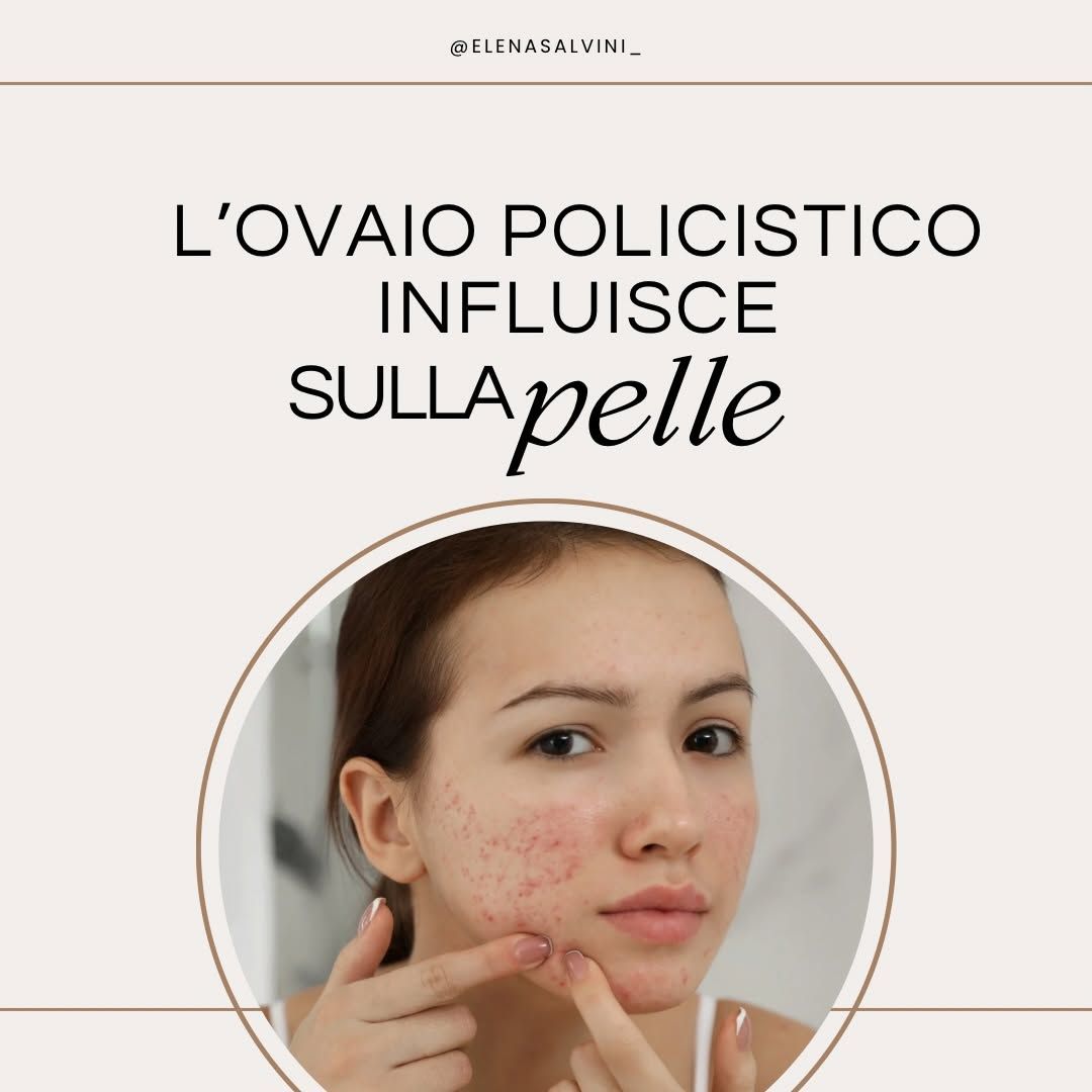 PCOS e pelle: perché la skincare non basta