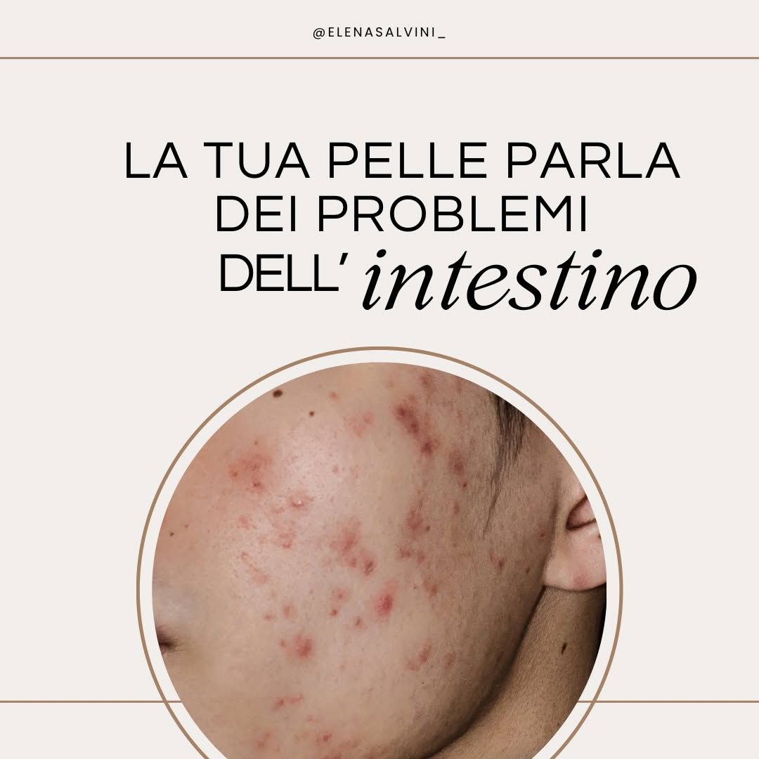 La tua pelle parla dei problemi dell'intestino